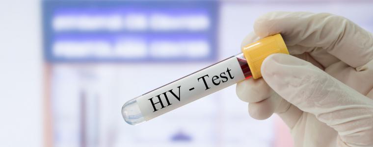 65 души са се изследвали за ХИВ в РЗИ-Добрич от началото на годината