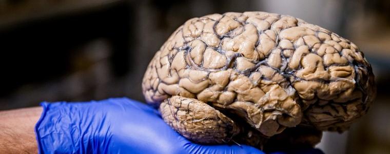 Загубата на памет е необходима за добре функциониращия мозък