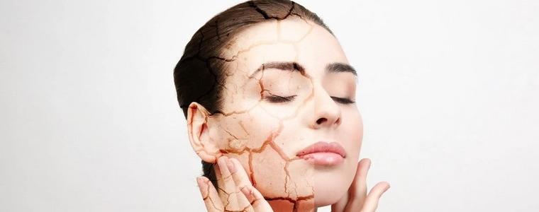 Най-добрите съвети на дерматолозите за облекчаване на сухата кожа