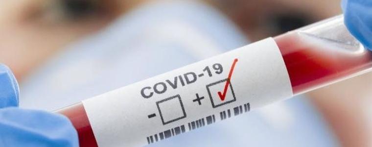 8 положителни проби от тази нощ, няма нови засегнати градове