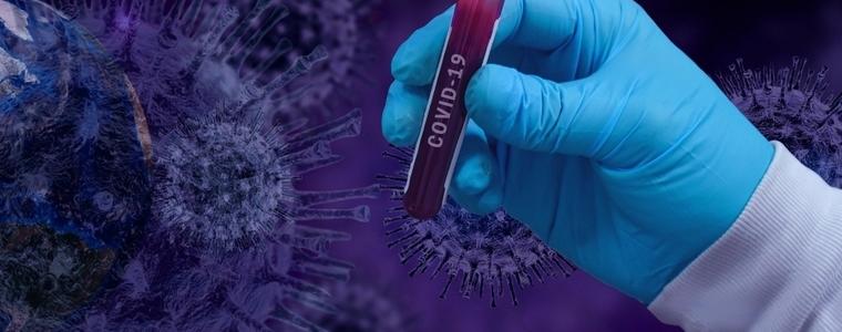 26 417 теста за коронавирус