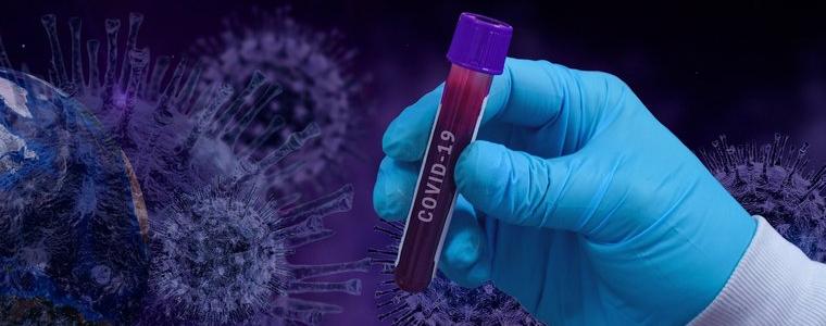 39 са новите случаи на заразени с коронавирус 