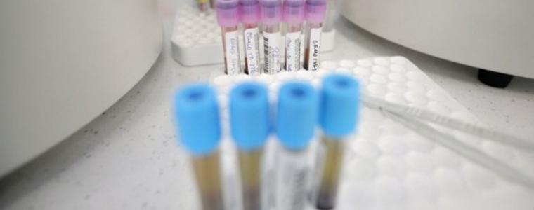 Нови 36 случая на COVID-19 у нас. Излекувани са 39 души