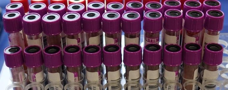 18 са новите доказани случаи на коронавирус в област Добрич