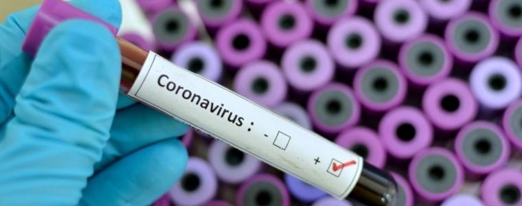 23-те положителни резултати за коронавирус в областта за ден са от 47 тествани