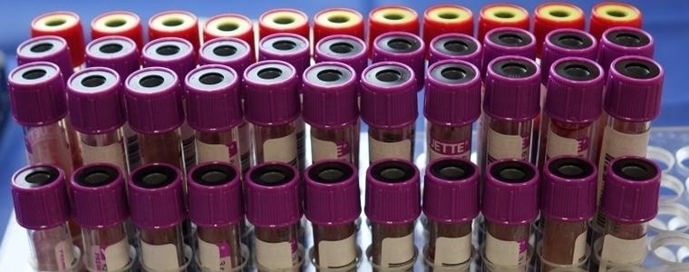 Още една жертва на коронавируса. 5 огнища в организирани колективи в Добрич