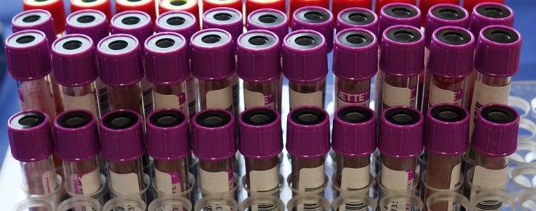 5 новоустановени случаи на коронавирус в област Добрич