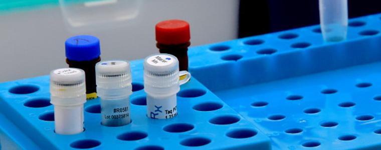 Нов антирекорд: 516 заразени с коронавирус