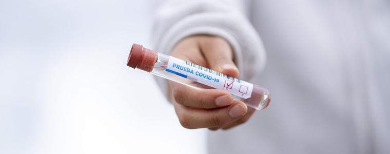 28 са новоустановените случаи на коронавирус в област Добрич