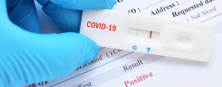 33-ма са жителите на Община Генерал Тошево с положителен PCR-тест, 7 от тях са в болница