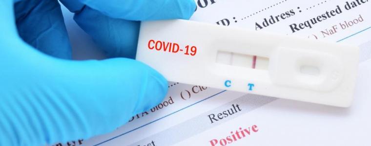 Проучват реакцията на имунитета при повторно заразяване с COVID-19
