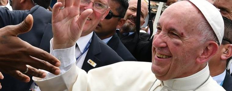 Папа Франциск напусна Колумбия с посинено око (ВИДЕО)