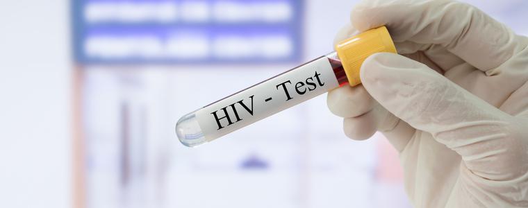 Откриха 240 нови случая на ХИВ/СПИН у нас