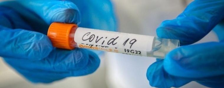 Случаите с коронавирус до днес са 190