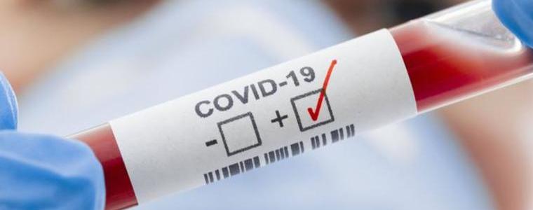 Случаите с коронавирус са общо 112 у нас