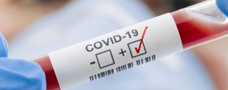 Спокойно: И четиримата с коронавирус са под домашна карантина, завърнали са се от чужбина