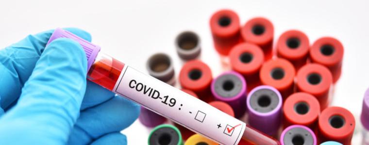 Турция ни дарява маски и тестове за COVID-19
