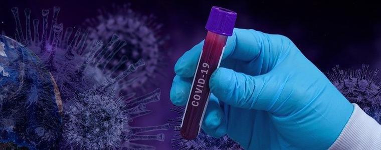 15 са новите случаи на коронавирус за днес