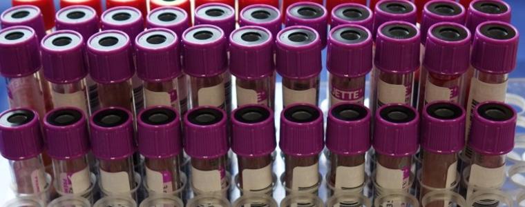 9 положителни проби за COVID 19 от сутринта до 17.00 часа