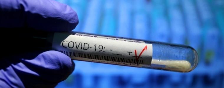8 нови случая на Covid-19 у нас са установени вчера