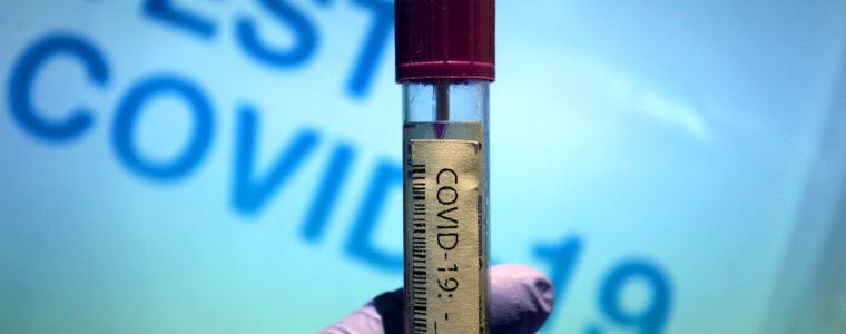 COVID-19 нямало да се превърне в чумата на 21 век