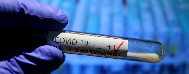 Над 5,4 млн. са вече заразените с коронавирус по света