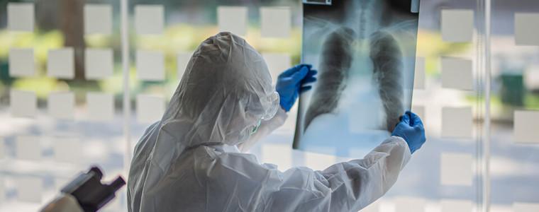 Още един починал с COVID-19, 1618 станаха регистрираните случаи