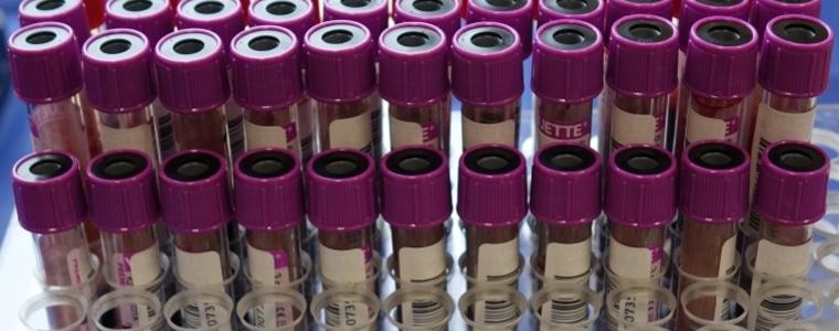 РЗИ-Добрич: Проверяват се проби от една социална институция седмично