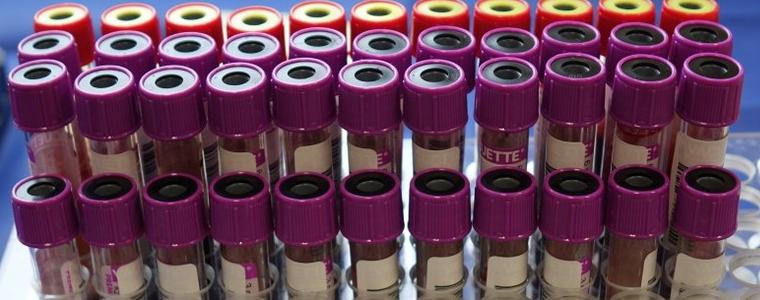 12 нови случаи на COVID-19  в областта, само трима от тях са в болница 