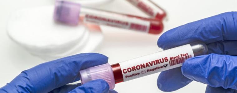 Данъчните подхванаха лабораториите заради тестовете за COVID-19