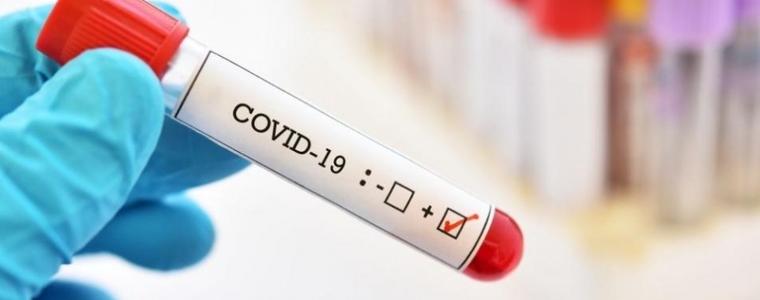 Доц. Чорбанов: Клетъчният имунитет ни лекува от COVID-19