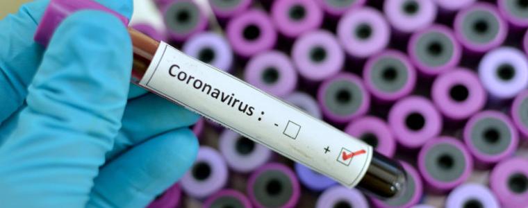 Нови 232 случая на коронавирусна инфекция у нас, 7 нови случая в Добрич 