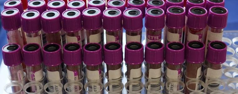 12 са новите случаи на коронавирус в област Добрич