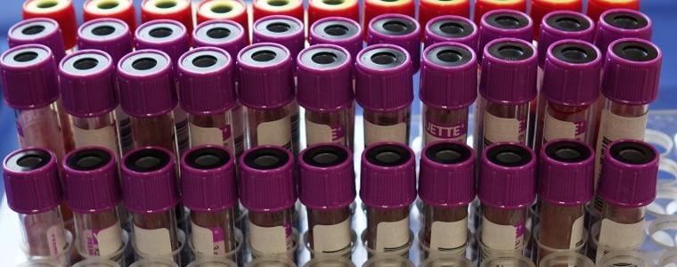 8 новорегистрирани с коронавирус в област Добрич