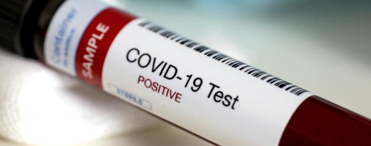 Нови 27-ковидзаразени в Добрич