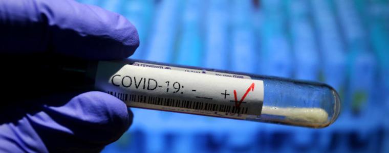 Учен от БАН: Гответе се за 25 000 заразени с COVID-19 в края на септември