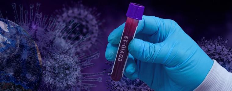 Учени, ръководени от българинц в Питсбърг, изолираха молекула срещу COVID-19