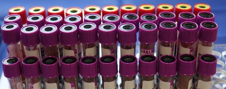 4 нови случая на Ковид-19 в област Добрич. Ръст на процентите положителни проби в страната