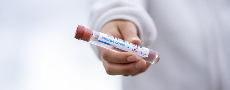 Един нов случай на коронавирус в област Добрич за денонощието