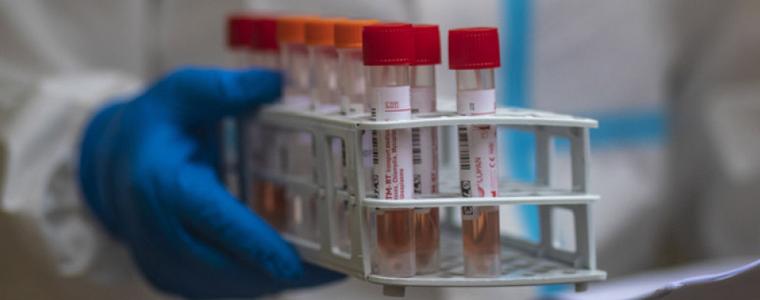 Рекордни над 10 хил. случая на Covid-19 на ден във Великобритания