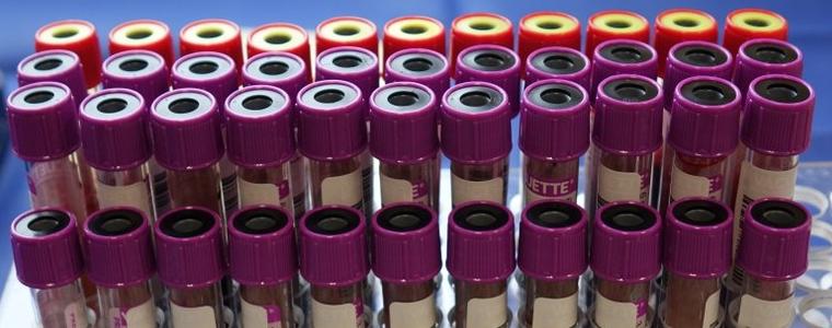 23 новоустановени случаи на коронавирус в област Добрич