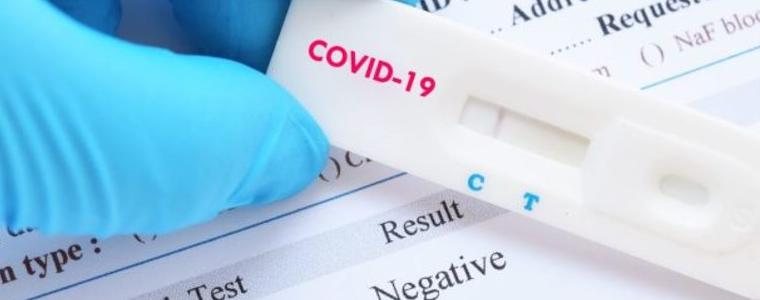 САЩ въвеждат задължителен тест за COVID-19 за всички пристигащи от Великобритания