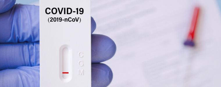 12 нови случаи на COVID-19  в областта, рекорден брой тестове в страната