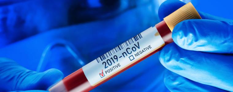 Провинция Хесен ще иска отрицателен тест за коронавирус от 9 януари