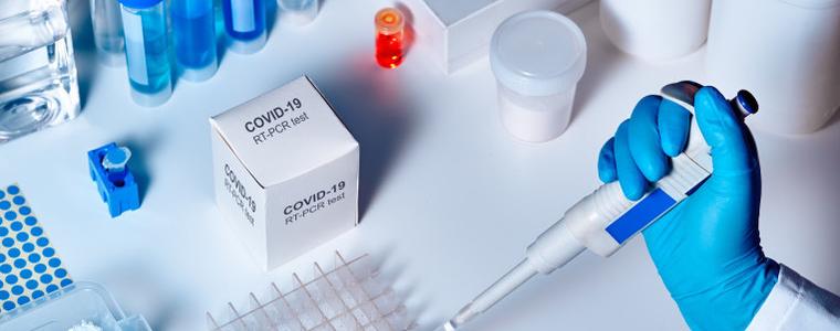 В 23 области ще има работещи лаборатории за PCR от днес до 3 януари