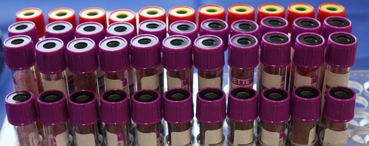 2/3 от пробите в Центъра по заразни болести са с британския щам