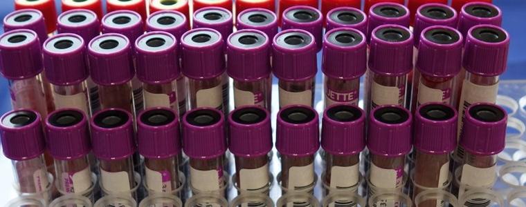 4 са новите регистрирани случаи на коронавирус в област Добрич