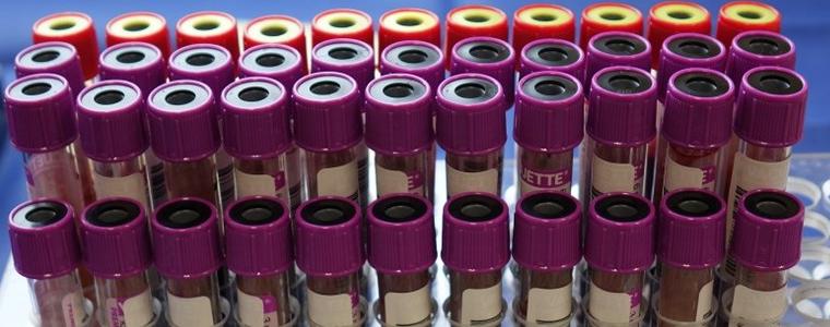 8 нови случаи на коронавирус в област Добрич, расте броят на новозаразените в страната