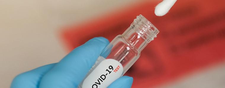 Отрицателен резултат от PCR-тест след пристигането на българи в страната ще отменя 10-дневната карантина