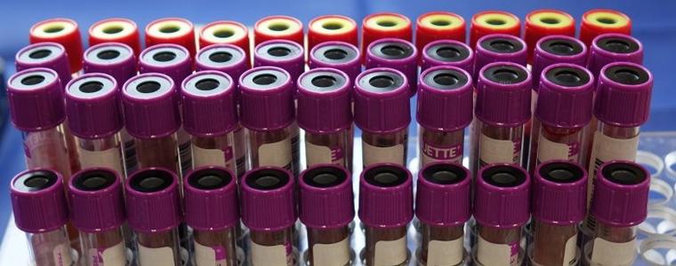 105 са новоустановените случаи на коронавирус в област Добрич